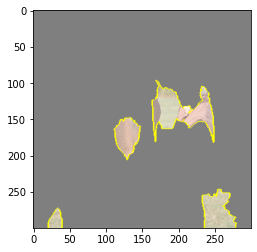 ../../../../_images/vision_neural_interpret_code_lime_48_1.png